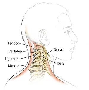 Whiplash in children recognizing and treating injuries in yo