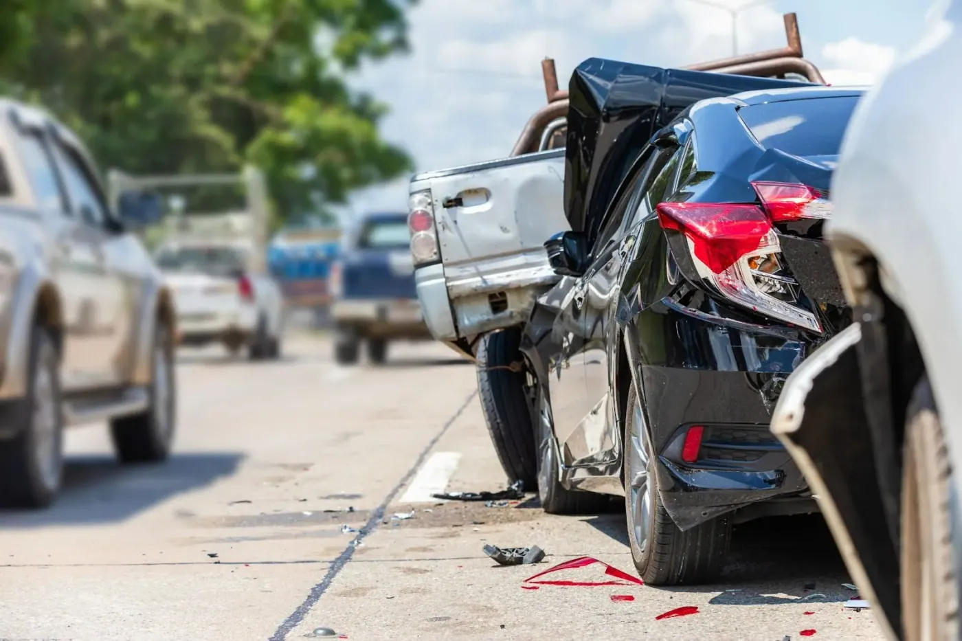Why you should see a chiropractor after an auto accident